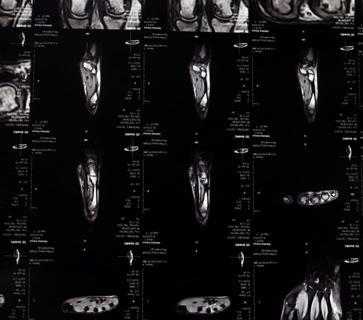 Artwork for Nihilist Syndrome