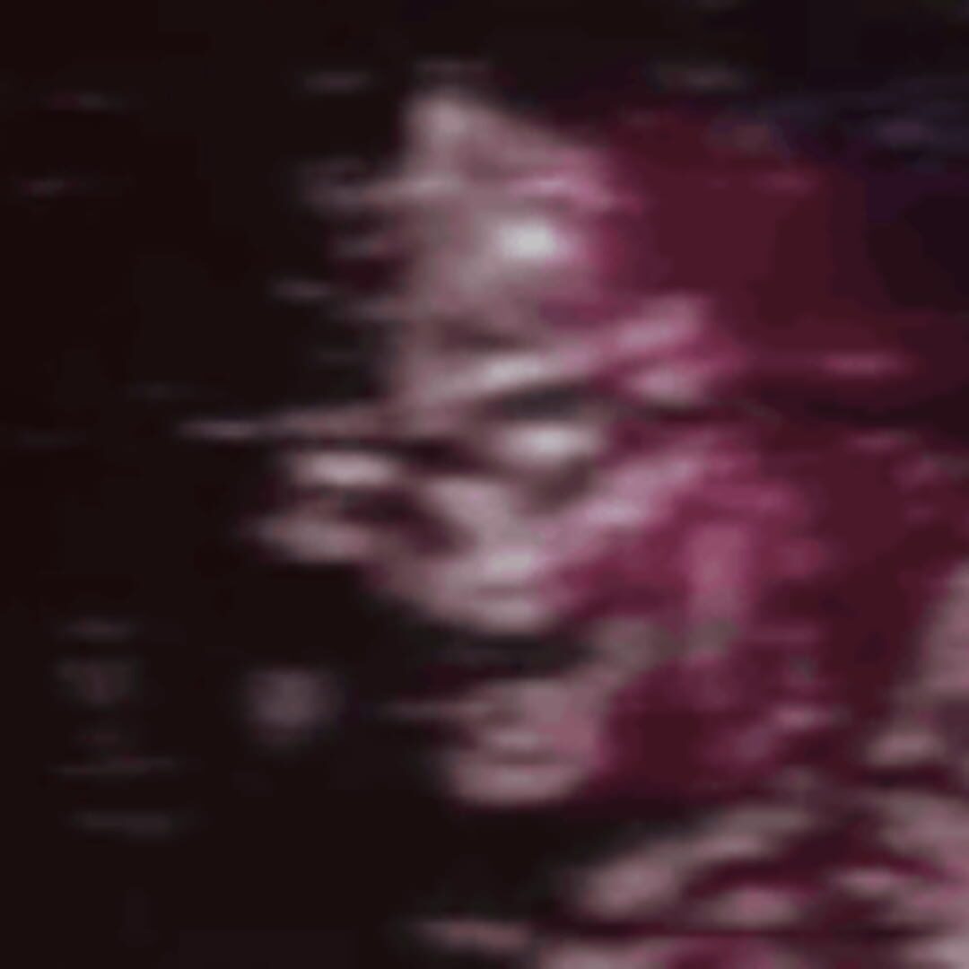 Tetric artwork