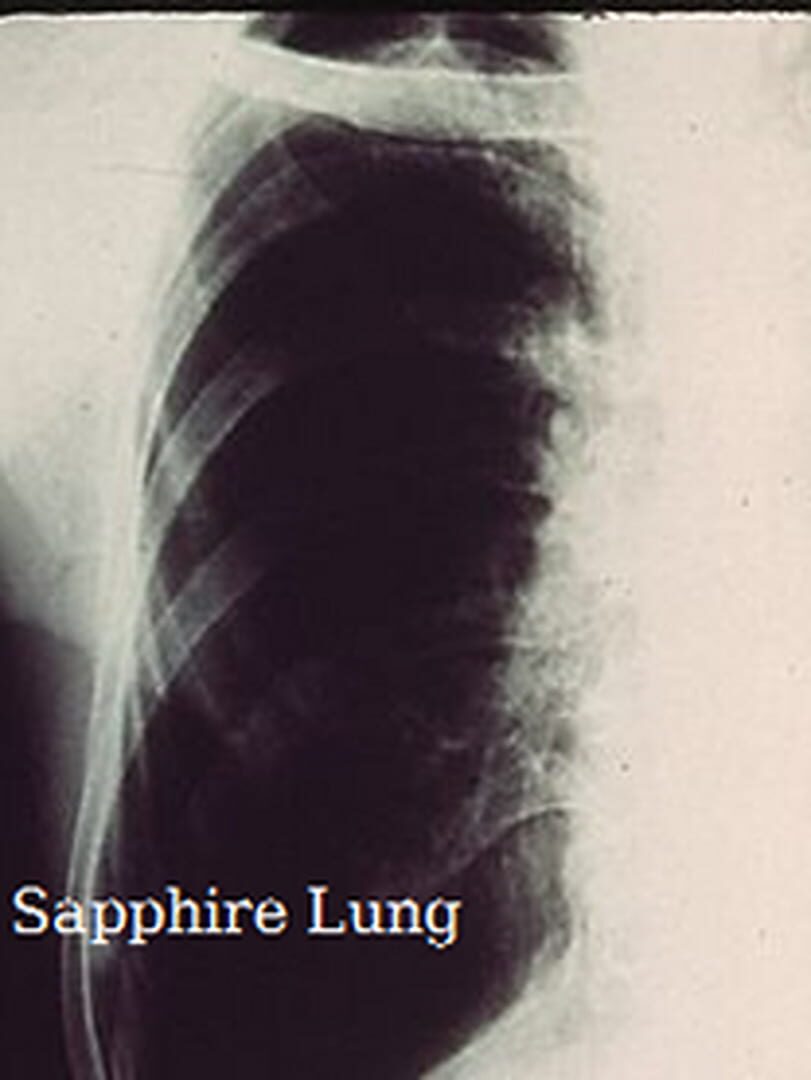 Sapphire Lung (2019)