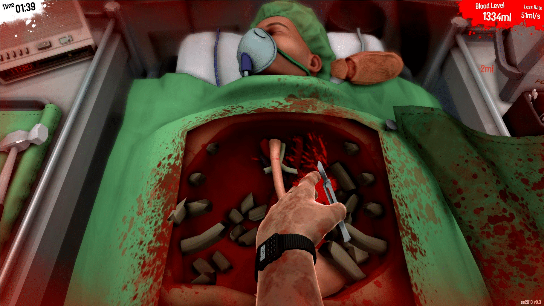 Surgeon Simulator 2013 screenshot