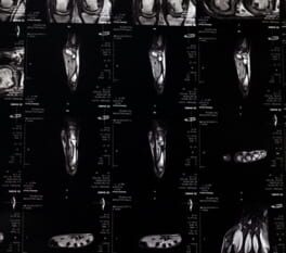 Nihilist Syndrome artwork 1