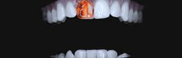 Teeth Cutter artwork 1