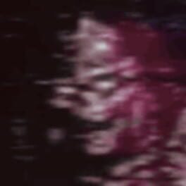 Tetric artwork 1