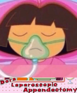 Dora Laparoscopic Appendectomy