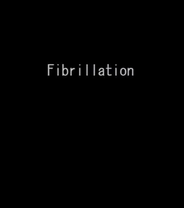 Image de couverture Fibrillation