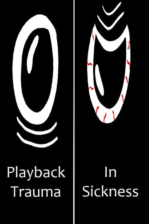 Playback Trauma: In Sickness screenshot