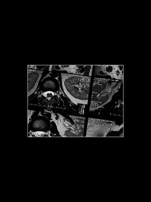 Capa de Nihilist Syndrome