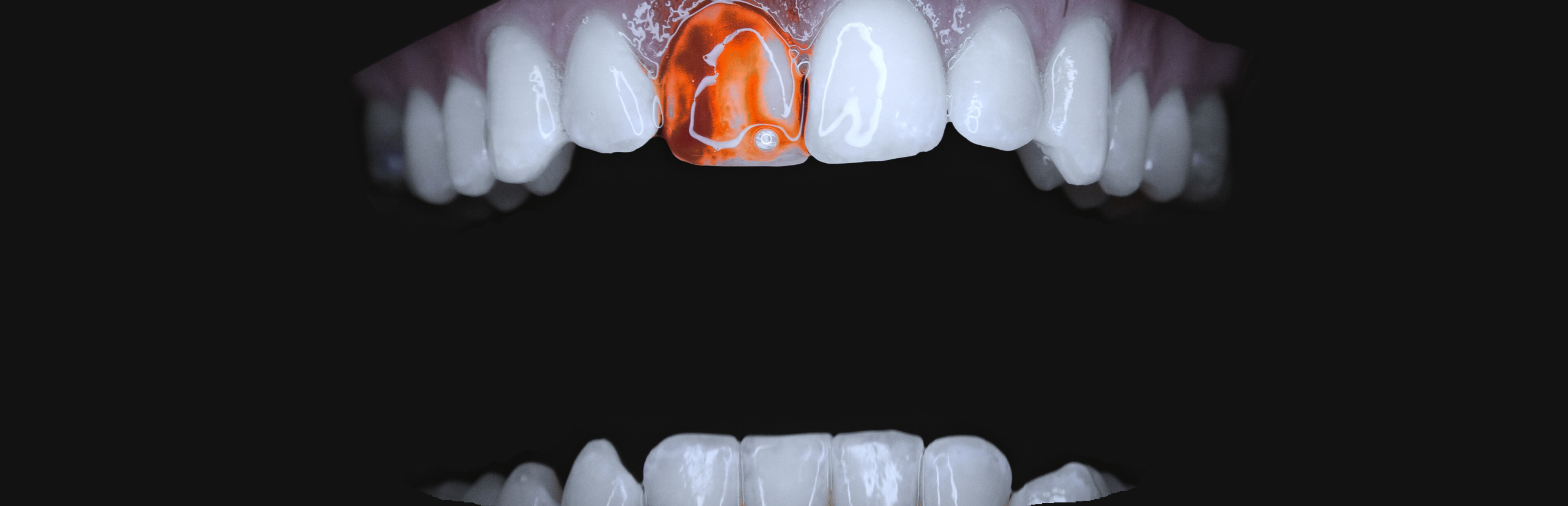 Game cover: Teeth Cutter