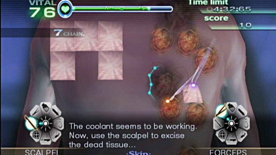 Trauma Center: New Blood screenshot