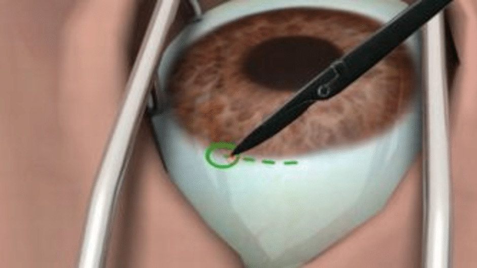Surgery Simulator Screenshot