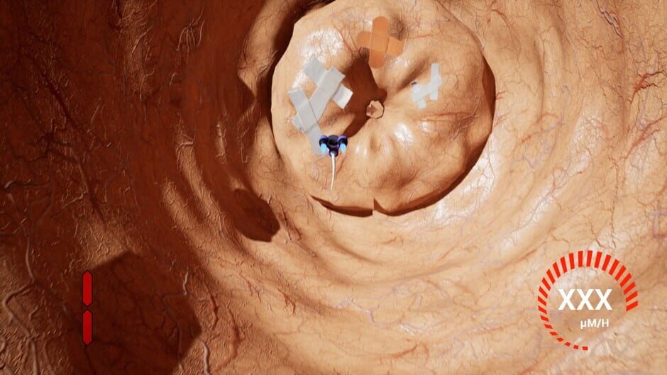 Spermula 1 Screenshot