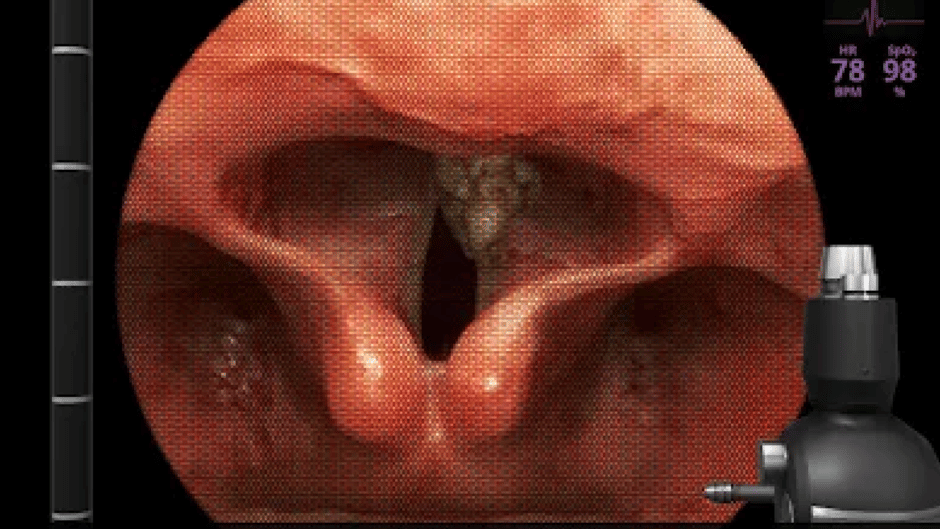 AirwayEx Screenshot