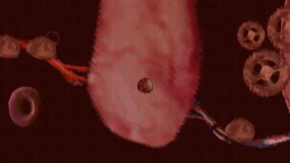 Blockage media thumbnail