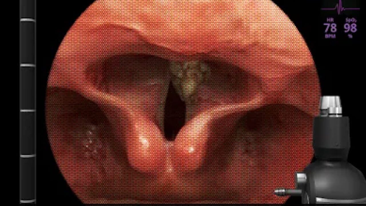 AirwayEx Screenshot 1