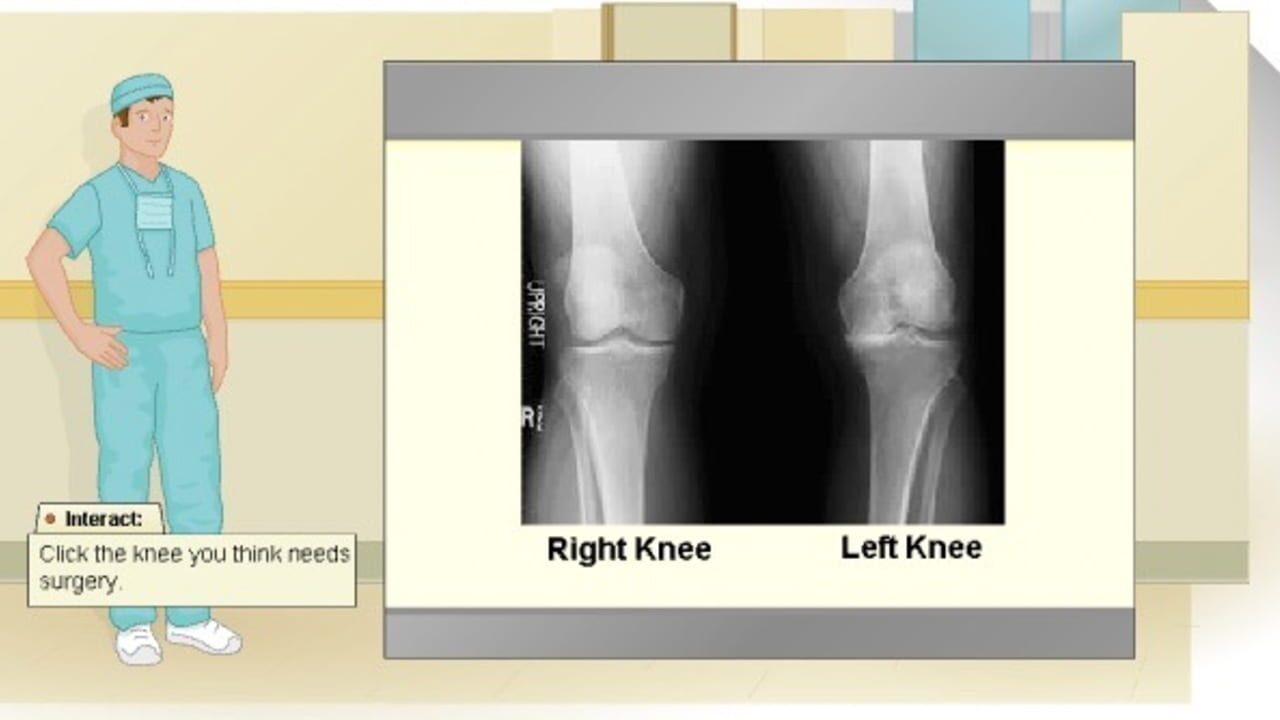 Virtual Knee Surgery Screenshot 1