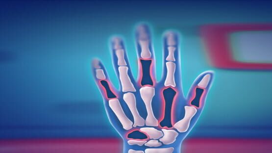Fix My Hand Doc gameplay screenshot