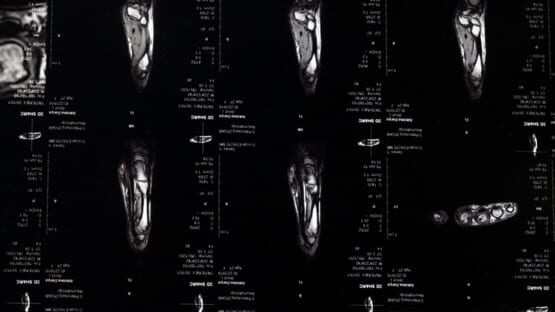 Nihilist Syndrome gameplay screenshot