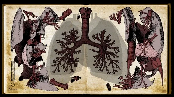 Wound Man screenshot 7