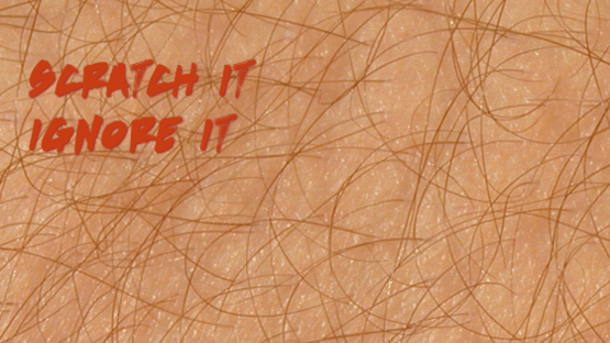 Itch Screenshot